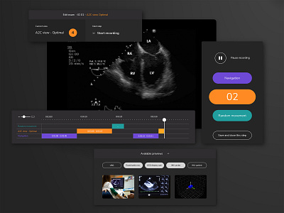 Echocardiography for machine learning app echocardiography heart machine learning recording timeline ukg usg