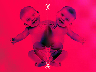 Conjoined twin babies separated collage design photoshop