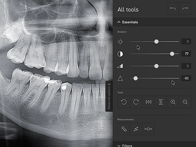 App ux aplication x-ray