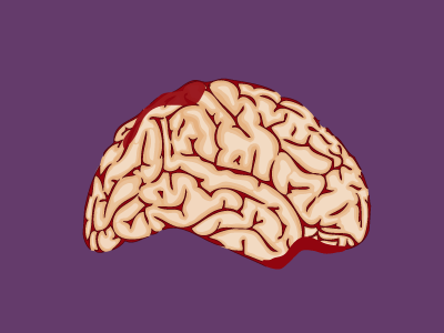 Brain brain