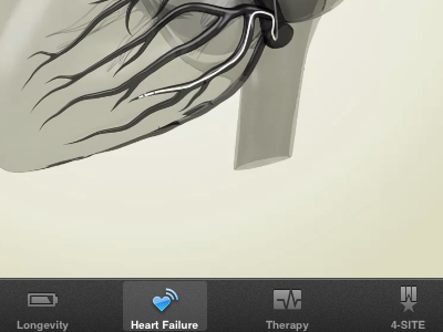 Heart Failure ipad ios