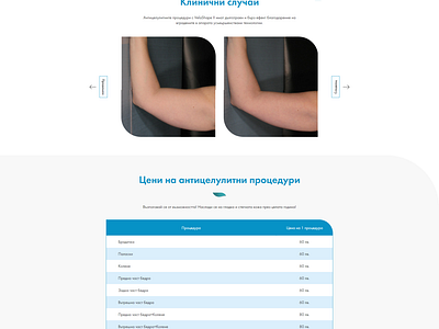 Before and After / Pricing Table / Beauty Center / Web Design