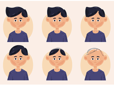 Hair Loss Stages Illustration age bald hair hairline head illustration loss male stages vector