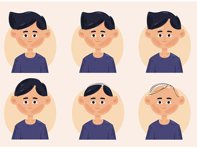 Hair Loss Stages Illustration age bald hair hairline head illustration loss male stages vector