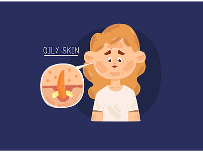 Oily Skin with Woman Face Illustration acne body face illustration makeup oily skin summer vector woman