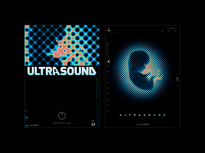 Ultrasound -