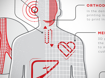 3D Printing in Healthcare infographic