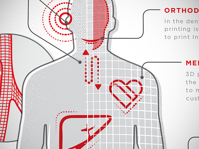 3D Printing in Healthcare