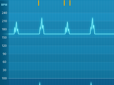 Medical App blue bpm chart data graph grid heartbeat