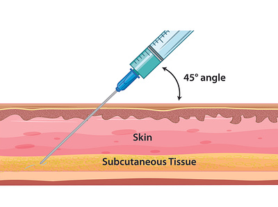 Skin Injection Illustration design graphic design illustration injection layers medical science skin