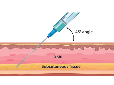 Skin Injection Illustration