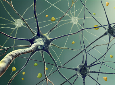 Parkinson's disease neurons parkinson photoshop scientific scientific illustration
