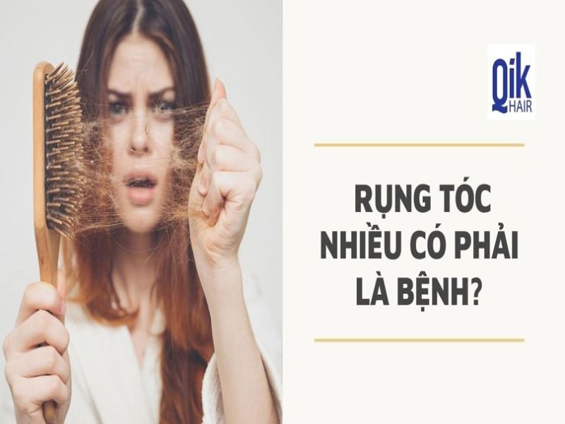 Rung toc nhieu : Nguyen nhan phan loai va cach dieu tri by Qik Hair on ...