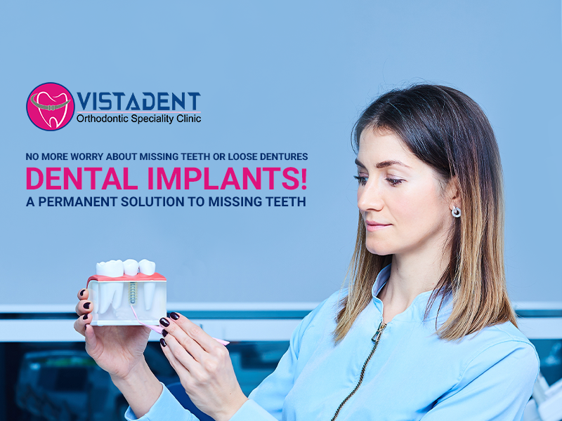 Dental Implant Surgeon in Hyderabad | Best Orthodontist near me by Vista Dent on Dribbble