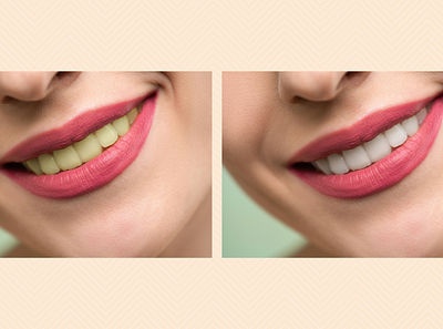 Teeth whitening in Photoshop hue photoshop photoshop editing saturation