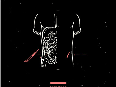 appendix appendix body illustration surgery