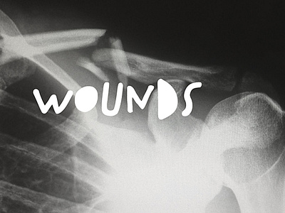 Wounds