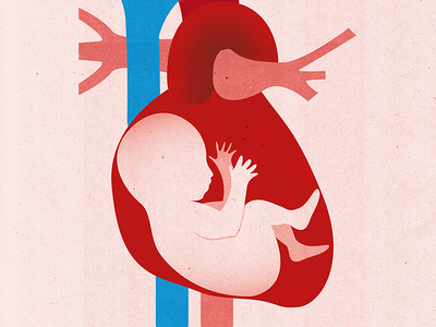 Congenital Disease anatomy baby cardiology conceptual editorial illustration graphic health healthcare healthy heart illustration institutional medical medicine patients pediatrics prevention print texture textured