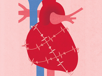 Arrhythmia anatomy cardio cardiology conceptual diagnosis diagnostics editorial editorial illustration health healthcare heart human body illustration illustrator medical medicine science texture textured textures