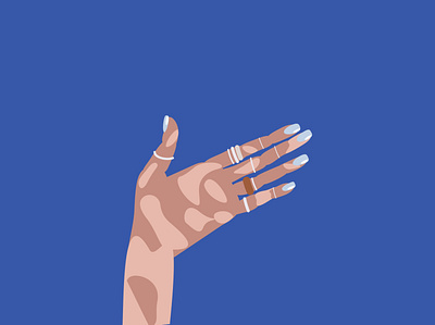 skin is a map blue colors hand hand illustration illustration vitiligo