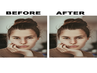 REMOVAL OF SPOTS FROM FACE editing