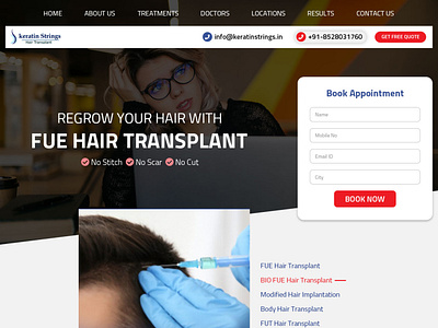 Hair Transplant