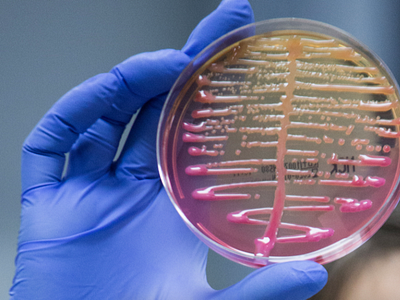 Browse thousands of Klebsiella Pneumoniae images for design inspiration ...