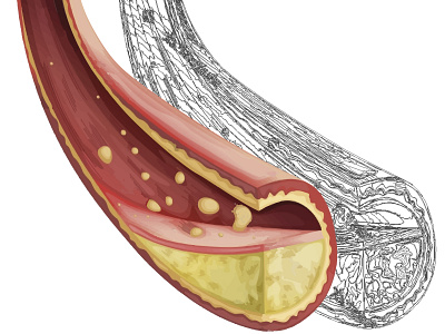 Artery section illustration