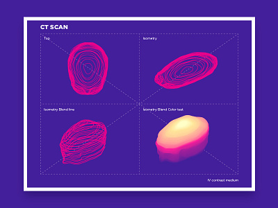 CTscan gradient illustration isometry medicine scan skull