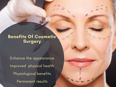 Benefits Of Cosmetic Surgery