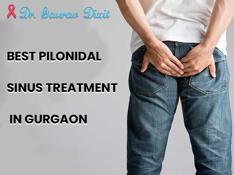 Best pilonidal sinus treatment in gurgaon by Dr Gaurav Dixit on Dribbble