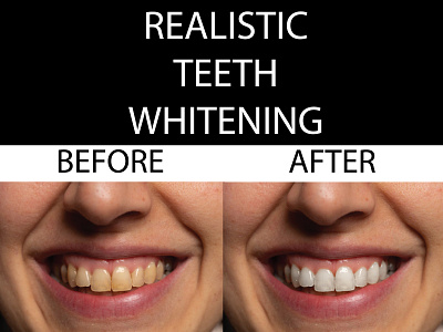 Realistic Teeth Whitening fashion fashion brand photo edit photo editing photoshop