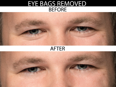 Eye Bags Removal photo edit photo editing photo editing services photoshop