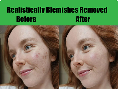 blemishes removed realistically