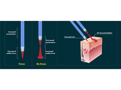 Power density for laser collagen graphic design illustration illustration design laser skin skincare vector