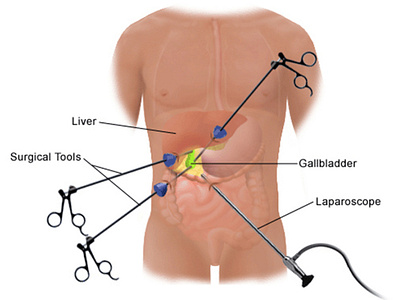 Laparoscopic Surgery Jalandhar