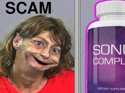 SONUS COMPLETE IS A SCAM does sonus complete work sonus complete tinnitus tinnitus supplements