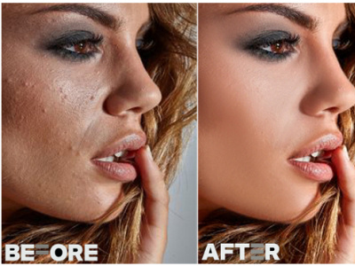 Pimples remove clean spot from your photo with high end retouch beauty retouch beauty retouching edit high end retouching photo edit photo retouching pimples remove pimples remove portrait retouch scars and spot remove scars and spot remove skin retouch