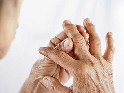 Arthritis and Rheumatic Diseases