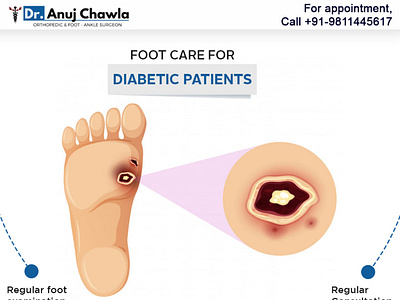 Diabetic Foot Treatment designs, themes, templates and downloadable ...