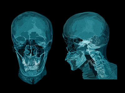 Skull x-ray backlighting fracture hospital krotalon skull x ray