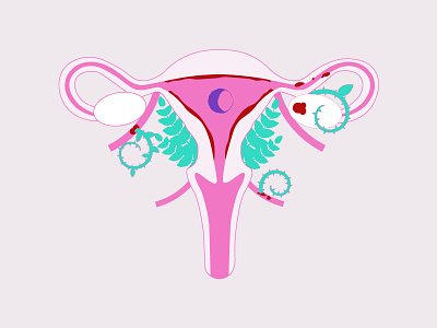 Endometriosis endometriosis illustration illustrator line uterus