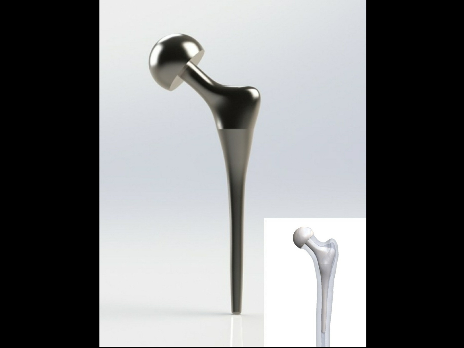 Hip Replacement Implant by Mohammed Shafeeq on Dribbble
