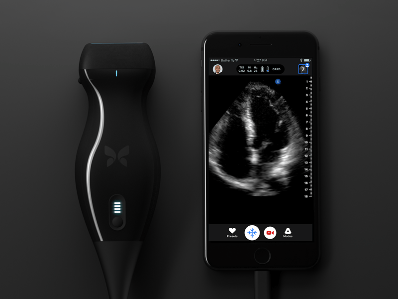 Meet iQ butterfly interface iphone iq product product design ui ultrasound ux