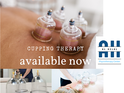 Cupping therapy branding cupping therapy physiotherapist physiotherapy sajzad digital