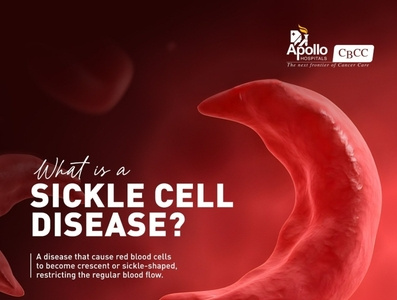 World Sickle Cell Day 2022 