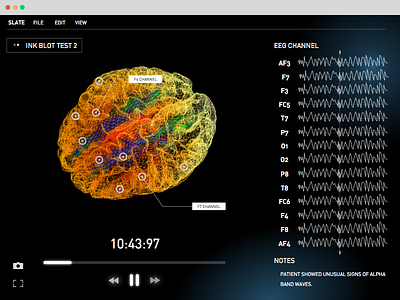 EEG Data Visualization