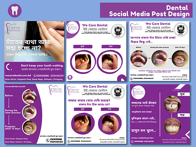 Social Media Post for Dental, Dentist, Clinic clinic dental post dentist post digital post facebook post graphic design instagram post medical post social media social media management social media manager