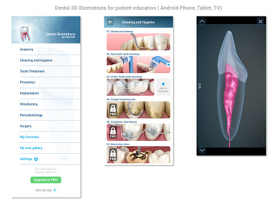 Dental 3D Illustrations for patient education 3d android app android app design app app design dental dental clinic dentist dentistry ui ux