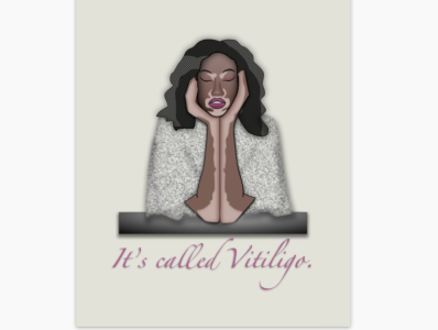 It's called Vitiligo. animation branding design graphic design icon illustration illustrator ui vector website